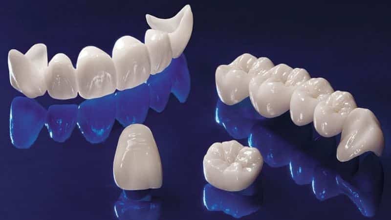każdy protezy zębów lepsze niż najlepsze protezy