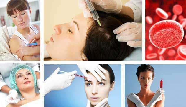 PRP-terapi i kosmetikk, trekk og fordeler Plazmolifting