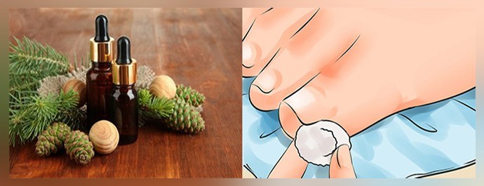 Aceite de abeto de hongos en las uñas: revisiones, instrucciones de uso.