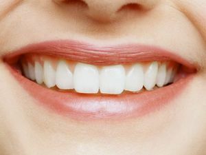 Уобичајени методи повећања зуба
