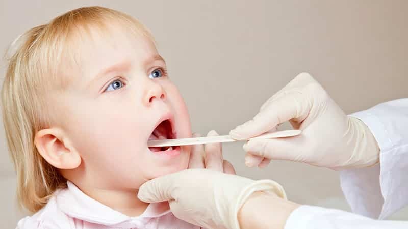 Children's stomatitis: symptoms and treatment at home