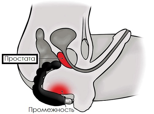 massageador próstata