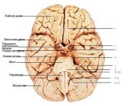 Struktur af hjernen