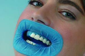 Os dentes são hoje isolado da saliva usando um material especial