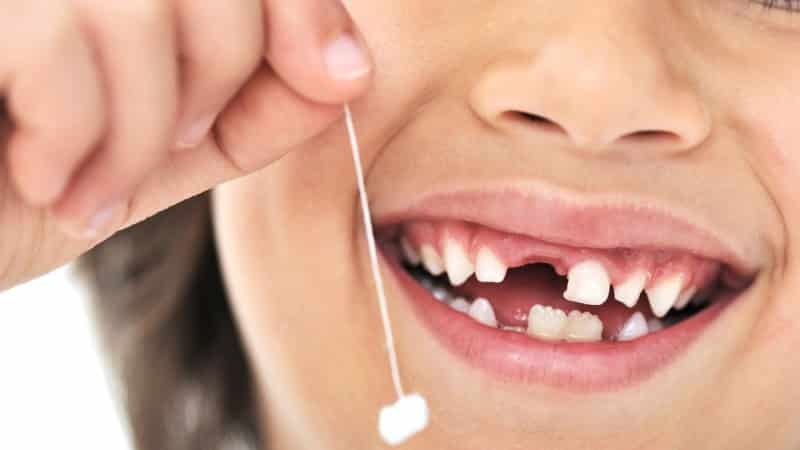 denti in ordine i bambini di cambiamento dei denti da latte per la permanente