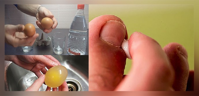 Behandeling van nagelschimmel met azijn op de voeten, handen: effectieve recepten, beoordelingen