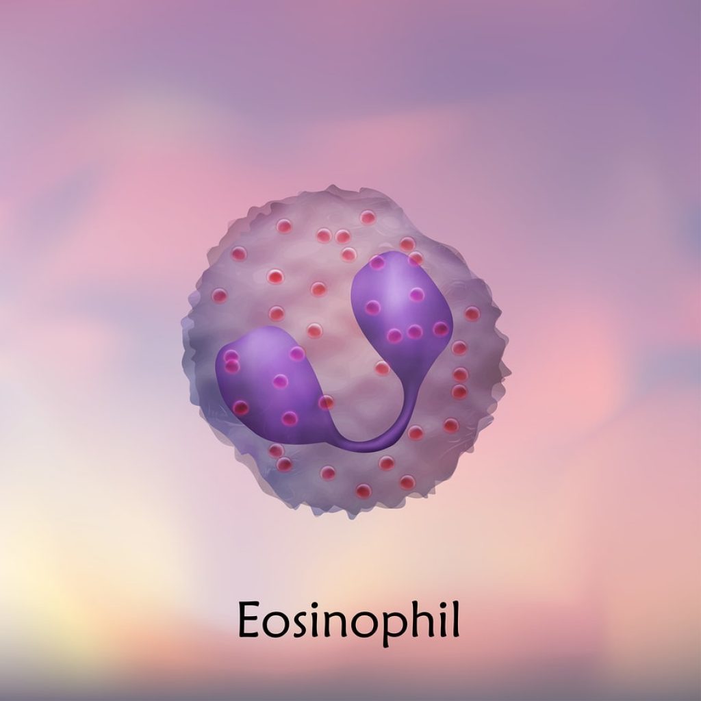 Eosinophils are elevated in an adult, what does this mean and what needs to be done