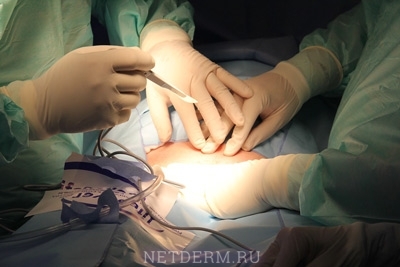 Chirurgie