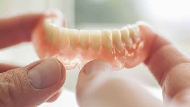 irrotettava hampaiden silikoni-implanttien