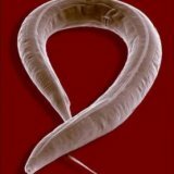Symptome der Enterobiasis und Behandlung von Pinwürmern