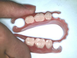 Tyypit hammasproteesit