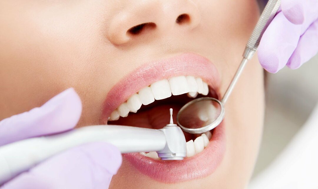 Kedokteran Gigi di Preobrazhenka. Perawatan karies