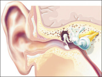 enfermedad del oído
