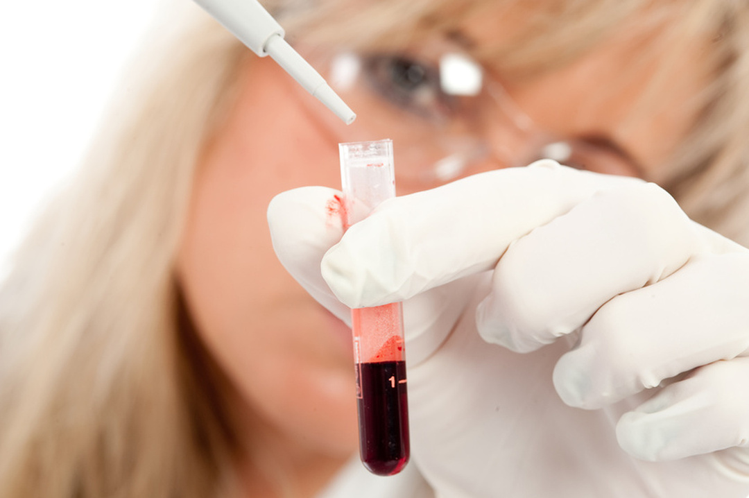 Hemodylucją - Wskazania i zasady stosowania leków i środków ludowej na krzepnięcie krwi