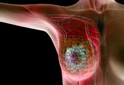 Immagini del cancro al seno