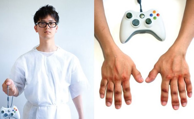 Gamers syndrom: Er dataspill trygt?