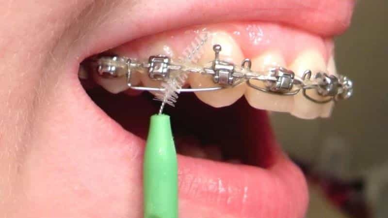 Cepillo de dientes para los frenos: Foto y normas de uso