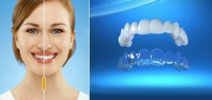 Skenorna - anordningar för tänderna anpassning: recensioner och pris