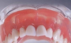 Como para se acostumar com as próteses dentárias, técnicas que aceleram este processo