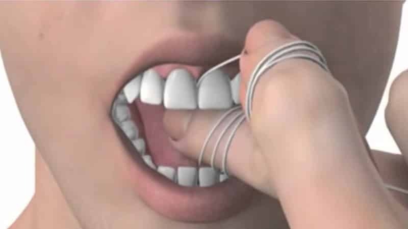 Foto tandtråd