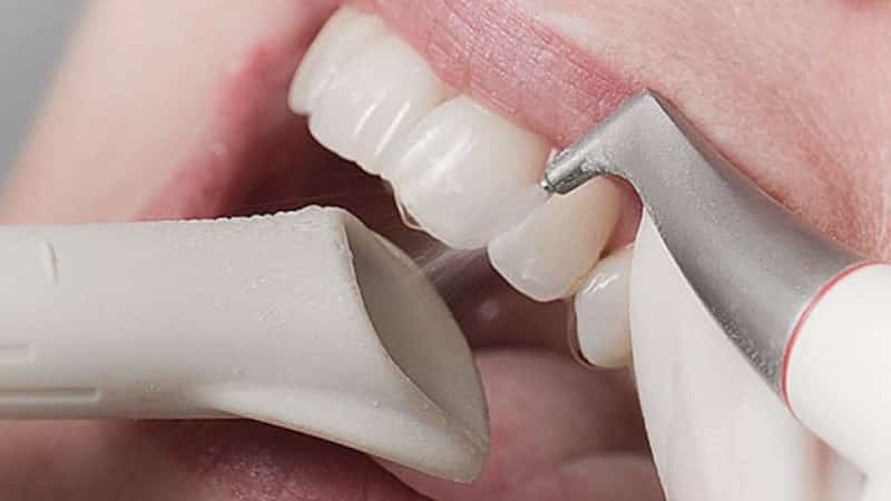implantater i periodontitt