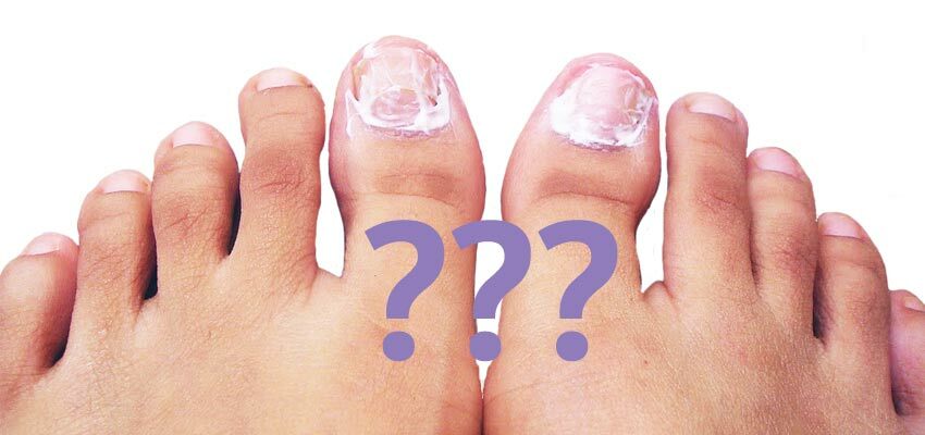Vilken salva från naglarnas svamp på fötterna och fötterna är bättre och effektivare?