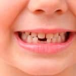 Vid vilken ålder förändras tänder hos barn