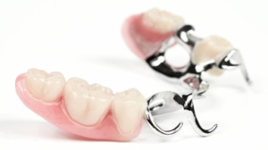 New generation dentures: price, benefits and description of models without palate