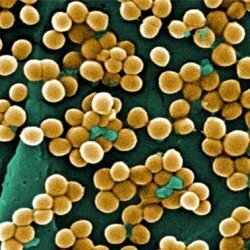 Bacteria cocci in the smear