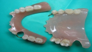 Erilaisia ​​hammasproteesia