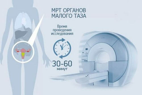 MRI z panvových orgánov u žien a mužov: ktorý ukazuje prípravu a kontraindikácie