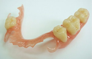 Mit herausnehmbarem Kunststoff und Acryl-Zahnprothesen, die Vor- und Nachteilen, vor allem der Pflege und Patientenberichte