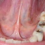 Jesu li vaši živci su u mliječnih zubi