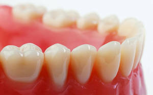 Siirrettävät ja ei-irrotettavien hammasproteesien