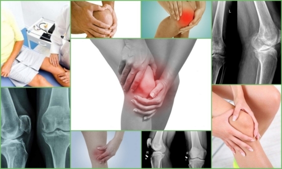Artralgi: typer, orsaker, symptom, behandling