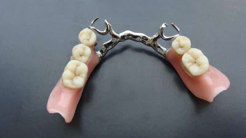 próteses modernas novas tecnologias dentes nos pinos