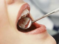Tandköttsproblem ger olika utmaningar