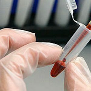 Blood test for lipids