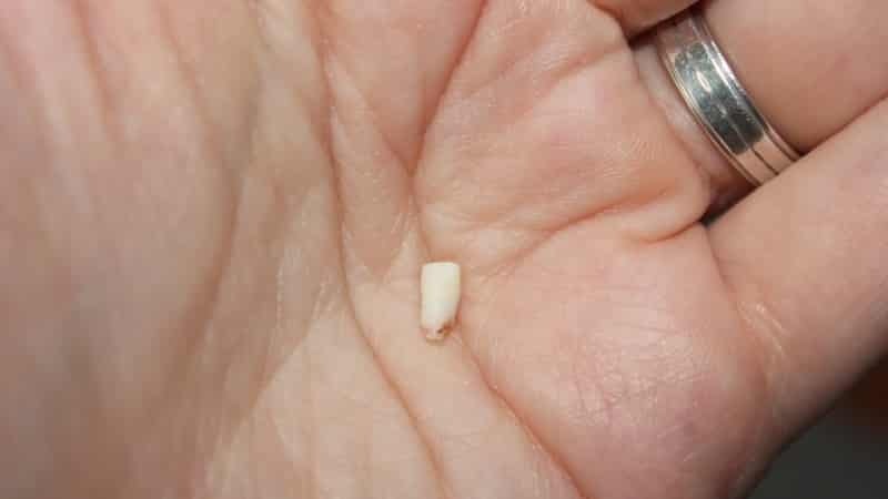 První zub dítěte vypadla, co dělat