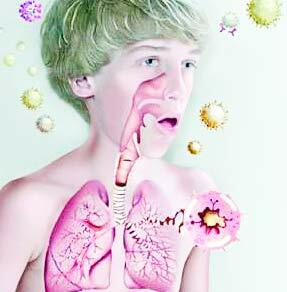 Allergier, orsaken till bronkial astma hos ett barn