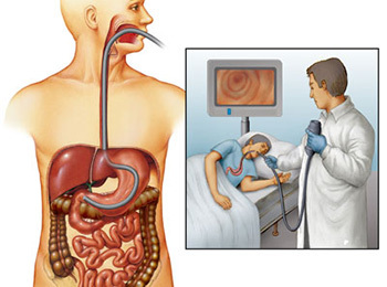 O endoscópio penetra no estômago do paciente