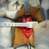 Behandlung des Schließmuskels der Harnröhre