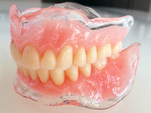 Features of nylon dentures