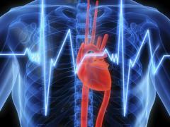 Lungenembolie ist eine schwere kardiovaskuläre Erkrankungen