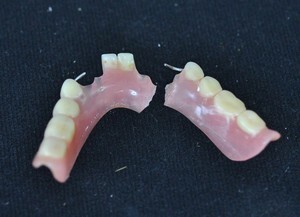 How it is possible to make at home a gluing of a dental prosthesis, a tooth: the basic recommendations