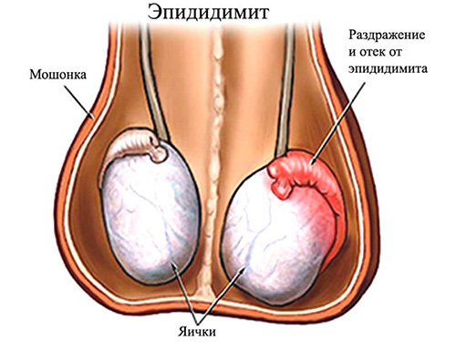 Adherence of the testicle - structure, function and disease