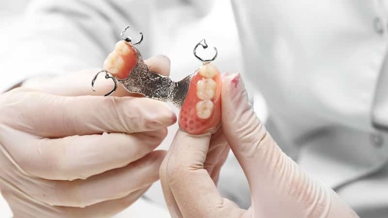 Pflege Haken Zahnersatz