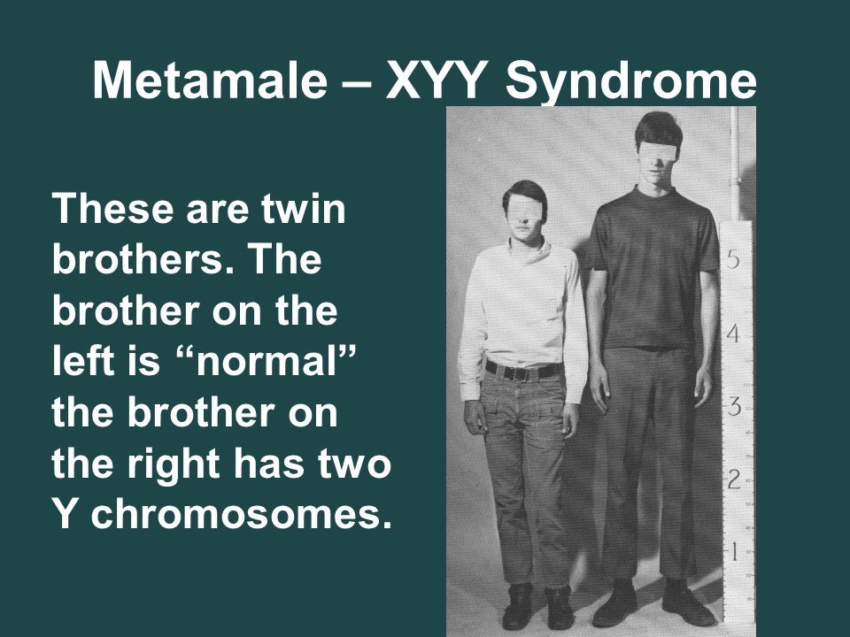 XYY syndrom: vad är det, orsaker, symptom (foto), behandling