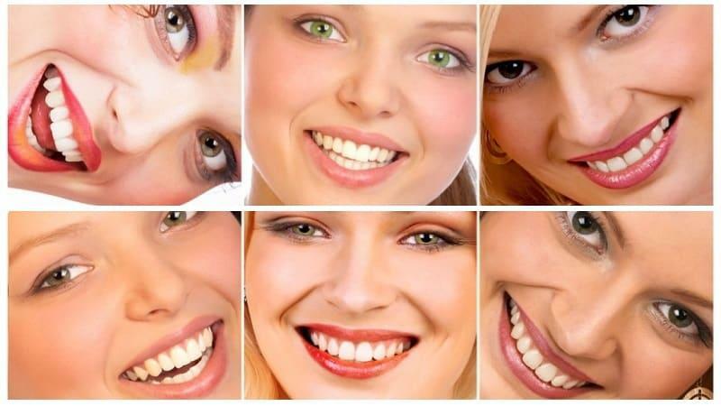 medel för blekning tänder hemma - blekmedel för tänder