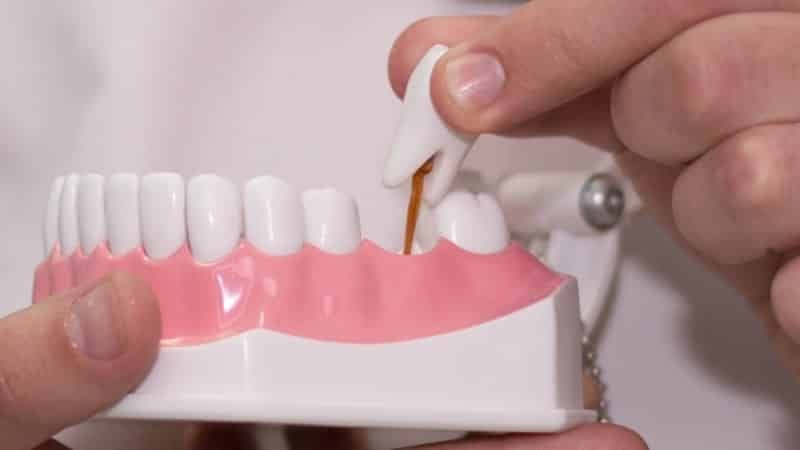um médico remove os dentes